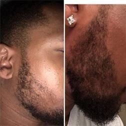 Олія для росту бороди Maxx Beard MaxxB фото
